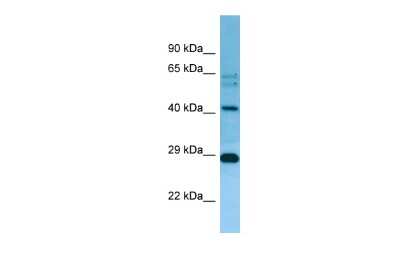 Western Blot: MRPL38 Antibody [NBP2-87825] - WB Suggested Anti-MRPL38 Antibody. Titration: 1.0 ug/ml. Positive Control: Jurkat Whole Cell