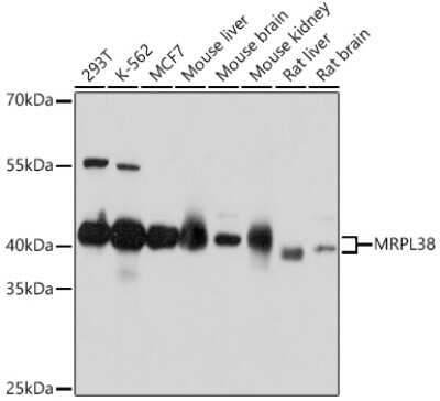 Western Blot: MRPL38 Antibody [NBP2-93579] - Analysis of extracts of various cell lines, using MRPL38 at 1:1000 dilution.Secondary antibody: HRP Goat Anti-Rabbit IgG (H+L) at 1:10000 dilution.Lysates/proteins: 25ug per lane.Blocking buffer: 3% nonfat dry milk in TBST.Detection: ECL Basic Kit .Exposure time: 5s.