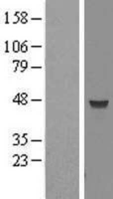Western Blot: MRPL38 Overexpression Lysate (Adult Normal) [NBL1-13263] Left-Empty vector transfected control cell lysate (HEK293 cell lysate); Right -Over-expression Lysate for MRPL38.