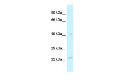 Western Blot: MRPL40 Antibody [NBP2-85318] - WB Suggested Anti-MRPL40 Antibody. Titration: 1.0 ug/ml. Positive Control: Fetal Liver