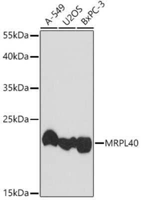 Western Blot: MRPL40 Antibody [NBP3-05233] - Analysis of extracts of various cell lines, using MRPL40 antibody at 1:1000 dilution. Secondary antibody: HRP Goat Anti-Rabbit IgG (H+L) at 1:10000 dilution. Lysates/proteins: 25ug per lane. Blocking buffer: 3% nonfat dry milk in TBST. Detection: ECL Basic Kit