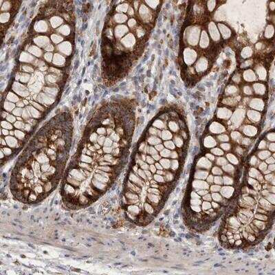 Immunohistochemistry: MRPL41 Antibody [NBP1-88571] - Staining of human rectum shows strong positivity in glandular cells.