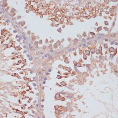 Immunohistochemistry-Paraffin: MRPL41 Antibody [NBP2-94391] - Paraffin-embedded rat testis using MRPL41 .