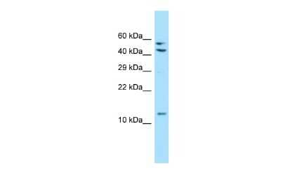 Western Blot: MRPL41 Antibody [NBP2-87826] - WB Suggested Anti-MRPL41 Antibody. Titration: 1.0 ug/ml. Positive Control: 293T Whole CellMRPL41 is supported by BioGPS gene expression data to be expressed in HEK293T