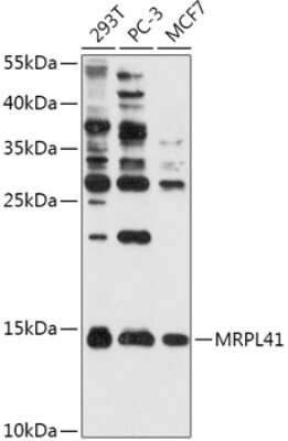 Western Blot: MRPL41 Antibody [NBP2-94391] - Analysis of extracts of various cell lines, using MRPL41 .Exposure time: 90s.