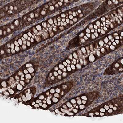 Immunohistochemistry-Paraffin: MRPL42 Antibody [NBP1-83171] - Staining of human colon shows strong cytoplasmic positivity in glandular cells.