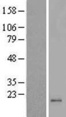 Western Blot: MRPL42 Overexpression Lysate (Adult Normal) [NBP2-05175] Left-Empty vector transfected control cell lysate (HEK293 cell lysate); Right -Over-expression Lysate for MRPL42.