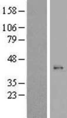 Western Blot: MRPL44 Overexpression Lysate (Adult Normal) [NBL1-13272] Left-Empty vector transfected control cell lysate (HEK293 cell lysate); Right -Over-expression Lysate for MRPL44.