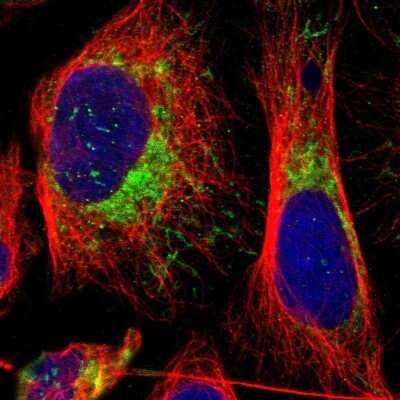 Immunocytochemistry/Immunofluorescence: MRPL45 Antibody [NBP1-82763] - Immunofluorescent staining of human cell line U-2 OS shows localization to mitochondria.