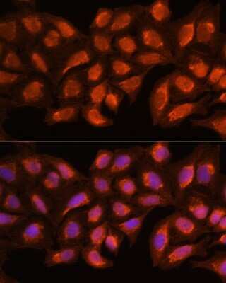 Immunocytochemistry/Immunofluorescence: MRPL45 Antibody [NBP2-93711] - Immunofluorescence analysis of Hela cells using MRPL45 Rabbit pAb (NBP2-93711) at dilution of 100 (40x lens). Blue: DAPI for nuclear staining.