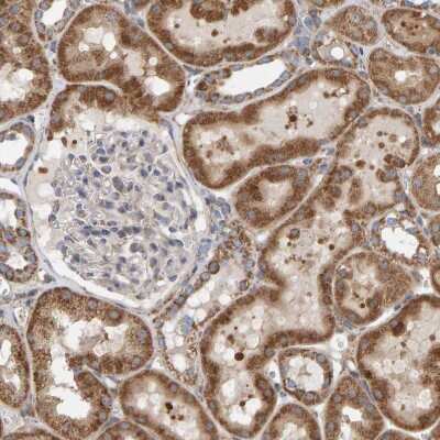 Immunohistochemistry-Paraffin: MRPL45 Antibody [NBP1-82763] - Staining of human kidney shows strong granular cytoplasmic positivity in cells in tubules.