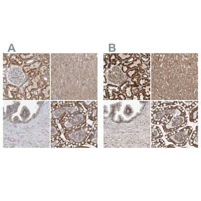 Immunohistochemistry-Paraffin: MRPL45 Antibody [NBP1-82763] - Staining of human kidney, liver, prostate and small intestine using Anti-MRPL45 antibody NBP1-82763 (A) shows similar protein distribution across tissues to independent antibody NBP1-82764 (B).