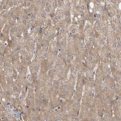 Immunohistochemistry-Paraffin: MRPL45 Antibody [NBP1-82763] - Staining of human liver shows  moderate granular cytoplasmic positivity in hepatocytes.