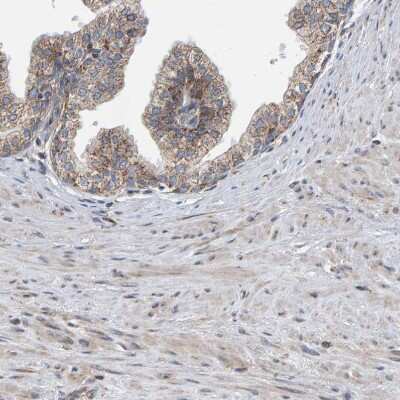 Immunohistochemistry-Paraffin: MRPL45 Antibody [NBP1-82763] - Staining of human prostate shows moderate granular cytoplasmic positivity in glandular cells.