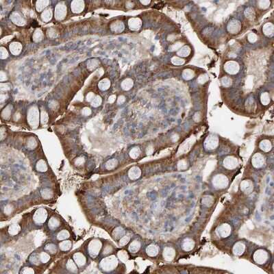 Immunohistochemistry-Paraffin: MRPL45 Antibody [NBP1-82763] - Staining of human small intestine strong granular cytoplasmic positivity in glandular cells.