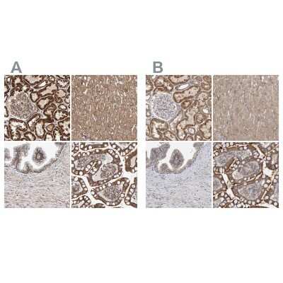 Immunohistochemistry-Paraffin: MRPL45 Antibody [NBP1-82764] - Staining of human kidney, liver, prostate and small intestine using Anti-MRPL45 antibody NBP1-82764 (A) shows similar protein distribution across tissues to independent antibody NBP1-82763 (B).