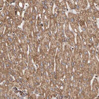 Immunohistochemistry-Paraffin: MRPL45 Antibody [NBP1-82764] - Staining of human liver shows  moderate granular cytoplasmic positivity in hepatocytes.