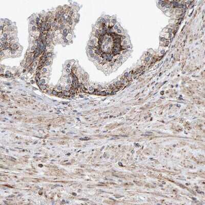 Immunohistochemistry-Paraffin: MRPL45 Antibody [NBP1-82764] - Staining of human prostate shows moderate granular cytoplasmic positivity in glandular cells.