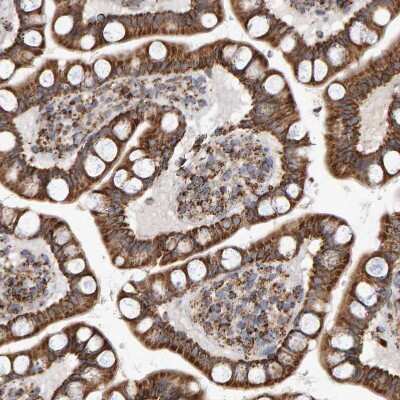 Immunohistochemistry-Paraffin: MRPL45 Antibody [NBP1-82764] - Staining of human small intestine strong granular cytoplasmic positivity in glandular cells.