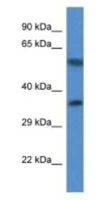 Western Blot: MRPL45 Antibody [NBP1-74261] - Human Fetal Heart Lysate, concentration 1 ug/ml.