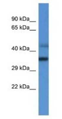 Western Blot: MRPL45 Antibody [NBP1-74262] - 293T Cell Lysate 1ug/ml  Gel Concentration 12%