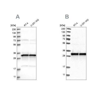 Western Blot MRPL45 Antibody - BSA Free