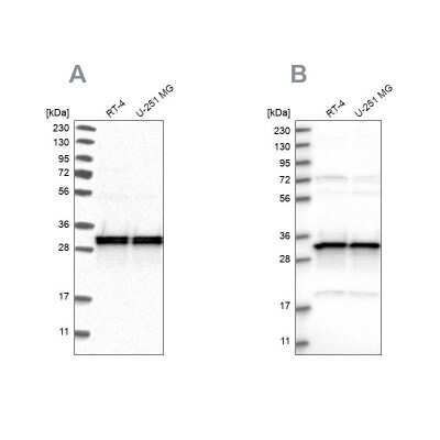 Western Blot: MRPL45 Antibody [NBP1-82764] - Analysis using Anti-MRPL45 antibody NBP1-82764 (A) shows similar pattern to independent antibody NBP1-82763 (B).