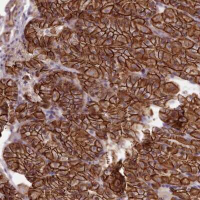Immunohistochemistry: MRPL46 Antibody [NBP2-47369] - Staining of human stomach, lower shows strong cytoplasmic and membranous positivity in glandular cells.