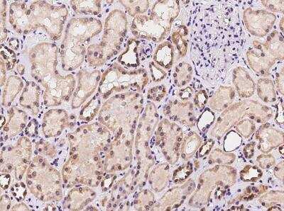 Immunohistochemistry-Paraffin MRPL47 Antibody - BSA Free
