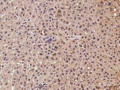 Immunohistochemistry-Paraffin MRPL47 Antibody - BSA Free