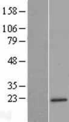 Western Blot: MRPL47 Overexpression Lysate (Adult Normal) [NBL1-13274] Left-Empty vector transfected control cell lysate (HEK293 cell lysate); Right -Over-expression Lysate for MRPL47.