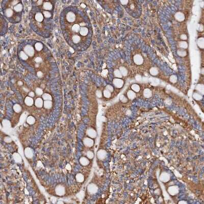 Immunohistochemistry-Paraffin: MRPL48 Antibody [NBP2-30586] - Staining of human duodenum shows moderate cytoplasmic positivity in glandular cells.