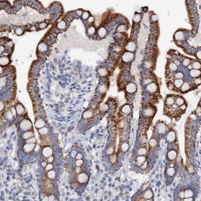 Immunohistochemistry-Paraffin: MRPL48 Antibody [NBP2-30963] - Staining of human colon shows strong cytoplasmic positivity in glandular cells.