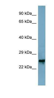 Western Blot: MRPL48 Antibody [NBP1-54676] - Jurkat cell lysate, concentration 0.2-1 ug/ml.