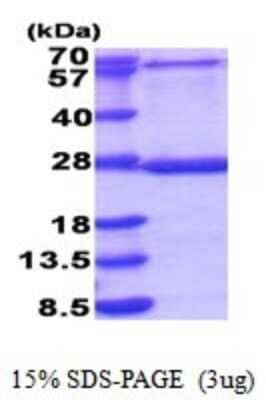 SDS-Page: MRPL48 Recombinant Protein [NBP2-51850] - 15% SDS Page (3 ug)