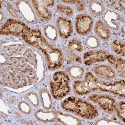 Immunohistochemistry-Paraffin: MRPL49 Antibody [NBP2-13618] - Staining of human kidney shows moderate cytoplasmic positivity in cells in tubules.