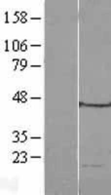 Western Blot: MRPL49 Overexpression Lysate (Adult Normal) [NBL1-13276] Left-Empty vector transfected control cell lysate (HEK293 cell lysate); Right -Over-expression Lysate for MRPL49.