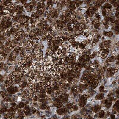 Immunohistochemistry-Paraffin MRPL50 Antibody