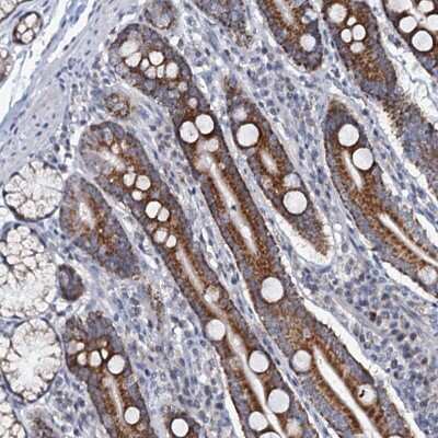 Immunohistochemistry-Paraffin MRPL51 Antibody