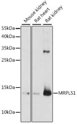 Western Blot: MRPL51 Antibody [NBP2-94233] - Analysis of extracts of various cell lines, using MRPL51 at 1:1000 dilution.Secondary antibody: HRP Goat Anti-Rabbit IgG (H+L) at 1:10000 dilution.Lysates/proteins: 25ug per lane.Blocking buffer: 3% nonfat dry milk in TBST.Detection: ECL Basic Kit .Exposure time: 90s.