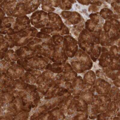 Immunohistochemistry-Paraffin MRPL52 Antibody