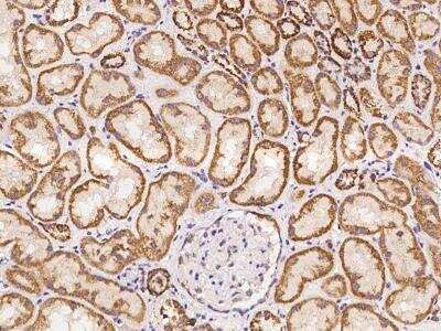 Immunohistochemistry-Paraffin MRPL52 Antibody