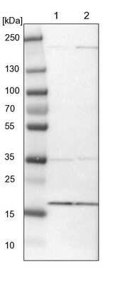 Western Blot MRPL52 Antibody