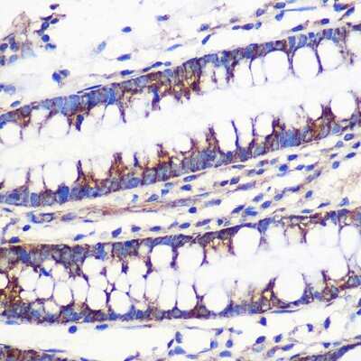 Immunohistochemistry-Paraffin: MRPL54 Antibody [NBP2-95150] - Immunohistochemistry of paraffin-embedded Human colon using MRPL54 Rabbit pAb (NBP2-95150) at dilution of 1:100 (40x lens). Perform microwave antigen retrieval with 10 mM PBS buffer pH 7.2 before commencing with IHC staining protocol.
