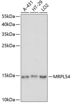 Western Blot: MRPL54 Antibody [NBP2-95150] - Analysis of extracts of various cell lines, using MRPL54 at 1:1000 dilution.Secondary antibody: HRP Goat Anti-Rabbit IgG (H+L) at 1:10000 dilution.Lysates/proteins: 25ug per lane.Blocking buffer: 3% nonfat dry milk in TBST.Detection: ECL Basic Kit .Exposure time: 30s.