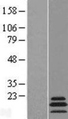 Western Blot: MRPL54 Overexpression Lysate (Adult Normal) [NBL1-13281] Left-Empty vector transfected control cell lysate (HEK293 cell lysate); Right -Over-expression Lysate for MRPL54.