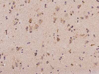 Immunohistochemistry: MRPL9 Antibody [NBP3-06270] - Immunochemical staining of human MRPL9 in human brain with rabbit polyclonal antibody at 1:100 dilution, formalin-fixed paraffin embedded sections.