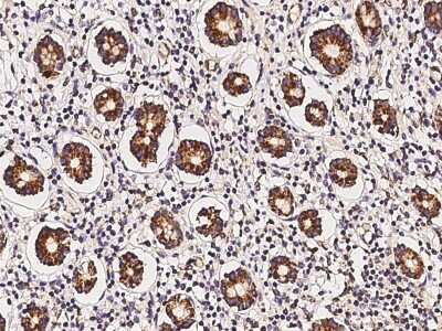 Immunohistochemistry-Paraffin: MRPL9 Antibody [NBP3-06270] - Immunochemical staining of human MRPL9 in human small intestine with rabbit polyclonal antibody at 1:100 dilution, formalin-fixed paraffin embedded sections.
