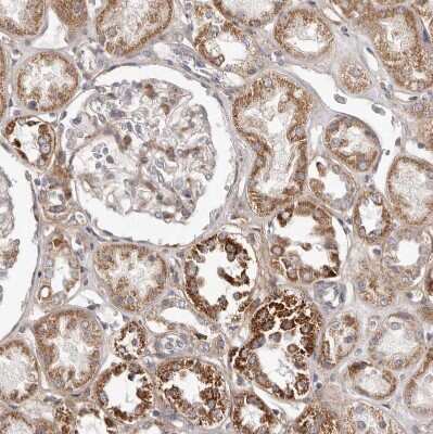Immunohistochemistry-Paraffin MRPS10 Antibody - BSA Free