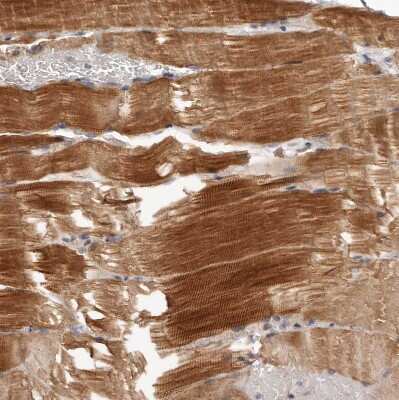 Immunohistochemistry-Paraffin MRPS10 Antibody - BSA Free